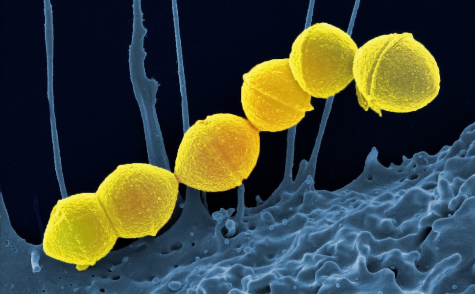 Streptococcus Pyogenes / Unsplash